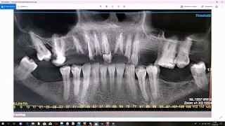 Онлайн-консультация стоматолога-ортопеда в Эстетикс