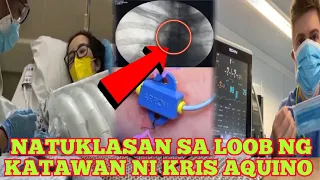 🔴BAGONG NATUKLASAN SA LOOB NG KATAWAN NI KRIS AQUINO IBINAHAGI NG KANYANG DOCTOR MUST WATCH