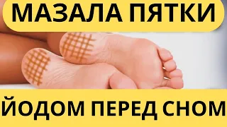 Что творит йод! Мазала пятки йодом перед сном , что творит йодная сетка