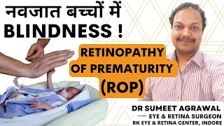 Retinopathy of Prematurity (ROP) ! नन्हें बच्चों को BLIND कैसे कर देती है ROP ?