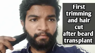 Trimming beard and haircut after beard transplant | tamil|