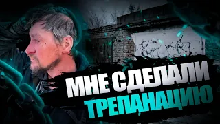 МНЕ СДЕЛАЛИ ТРЕПАНАЦИЮ ЧЕРЕПА! | ЖИВУ НА УЛИЦЕ УЖЕ 10 ЛЕТ | Жизнь на дне #4 | #Помощь #Жизньнадне