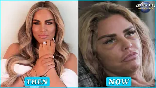 20 Celebrity Plastic Surgery Disasters That You Didn't Expect | Celebrities Then And Now