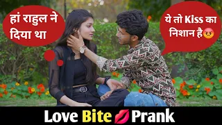 Prank On Boyfriend | Love Bite💋 Prank On My Boyfriend | Gone Extremely Angry😡 | Shitt Pranks