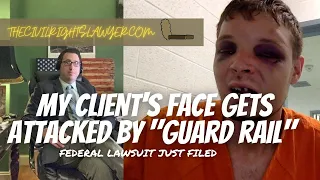 My Client’s Face Has Freak Encounter with a “Guard Rail” - Civil Rights Lawsuit Filed