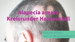 Kreisrunder Haarausfall (Alopecia areata)  - Ursache & Behandlung - Einfach erklärt von Dr. Durani