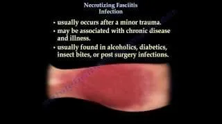 Necrotizing Fasciitis  - Everything You Need To Know - Dr. Nabil Ebraheim