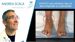 Effetti collaterali delle infiltrazioni di cortisone in ortopedia | Dott. Andrea Scala