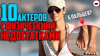 10 АКТЕРОВ С ФИЗИЧЕСКИМИ НЕДОСТАТКАМИ