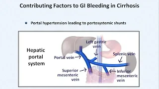 Esophageal Varices and Variceal Hemorrhage