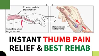 De quervain’s tenosynovitis exercises by Mr Physio: wrist thumb pain relief