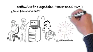 Conoce todo sobre la Estimulación Magnética Transcraneal (EMT)