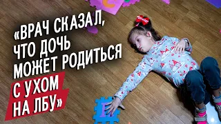 У моей дочери синдром Вольфа-Хиршхорна: Елена | Быть мамой