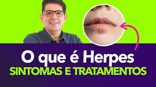 Herpes: tipos, sintomas e tratamentos | Dr Juliano Teles