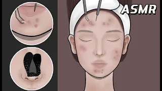 Skincare Stop Motion ASMR | Remove Makeup & Facial Treatment ❤ | Pop Pimples 【Mengmation】