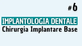 Implantologia Dentale - Chirurgia Implantare Semplice