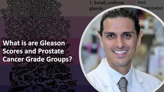 What are Prostate Cancer Gleason Scores and Grade Groups? – Dr. Ahdoot explains