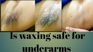 Is waxing best for undersrms /Is bleeding normal after waxing