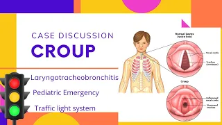 Case Discussion || Paediatric Emergency || Croup