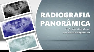 Aula: Radiografia Panorâmica