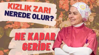 Kızlık Zarı Nerede Olur? | Sizinki ne Kadar Geride?