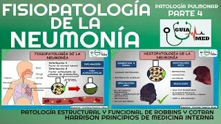 NEUMONÍA ADQUIRIDA EN LA COMUNIDAD (FISIOPATOLOGÍA PARTE 1)| GuiaMed