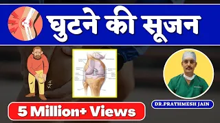 Swelling in Knee Joint(Hindi) घुटने की सूजन ,घुटने में पानी भर गया है, Knee Pain and Swelling