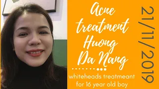 Whiteheads treatmeant for 16 year old boy | 21/11/2019