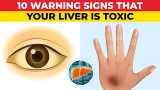 10 Warning Signs of a Toxic Liver