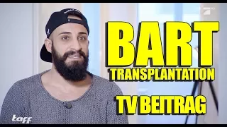 Ich war im TV! 🎥 Barttransplantation | BARTMANN