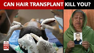 Can You Die Of Hair Transplant Surgery? Doctors Explain