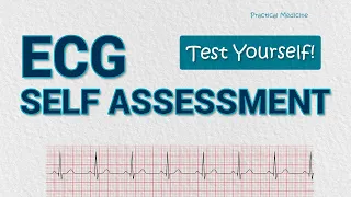 Test Your ECG Knowledge | 30 ECGs Quiz