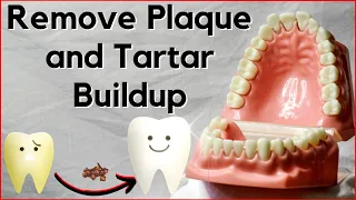 5 Easy Natural Ways to Remove Plaque and Tartar Buildup from Your Teeth