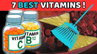 Top 7 Vitamins That Are BEST For PREVENTING Calcium Buildup & Arterial Clogging | Vitality Solutions