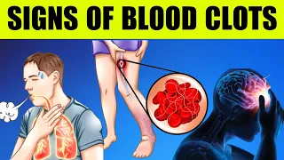 TOP 9 Warning SIGNS of BLOOD CLOTS - Bestie Foods