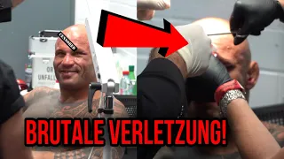 Alter..CHRISTIAN JUNGWIRTH vom ARZT BEHANDELT nach BRUTALER SCHLACHT bei OKTAGON!