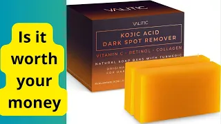 VALITIC Kojic Acid Soap Bars Review: Dark Spot Remover Power!