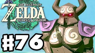 Misko's Treasures! - The Legend of Zelda: Tears of the Kingdom - Gameplay Part 76