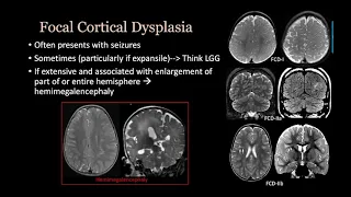 imaging Congenital malformation  Brain and spine