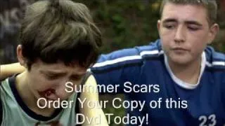 - Movie - Summer Scars!