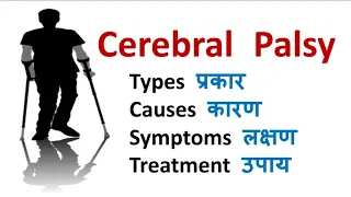 Cerebral Palsy | Causes, Symptoms, Prevention, Treatment and Risk factors | Palsy | In Hindi
