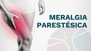 Meralgia parestésica - Dor e formigamento na parte de fora da coxa