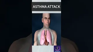 Asthma Attack #shorts #youtubeshorts
