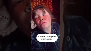 У меня синдром картошки #юмор#смешныевидео