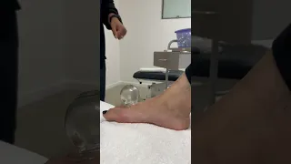 🔥🔥FIRE CUPPING 🔥🔥 foot pain! #asmr #chiropractic #asmrsounds #sydney #shorts