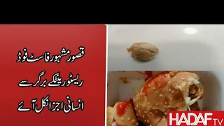 Human meat in Pakistan, Burger main insani gosht