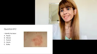 Skin Lesions Q&A Explanation Video with Q images