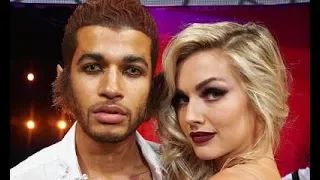 Lindsay Arnold Suffers DWTS Injury and we hope she will ok