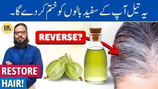 Amla Ka Tel Lagane Ke Fayde | Amla Oil Benefits for Hair/Scalp | Dr. Ibrahim