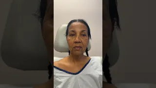 Amazing Facelift Transformation on 62 Year Old Woman!